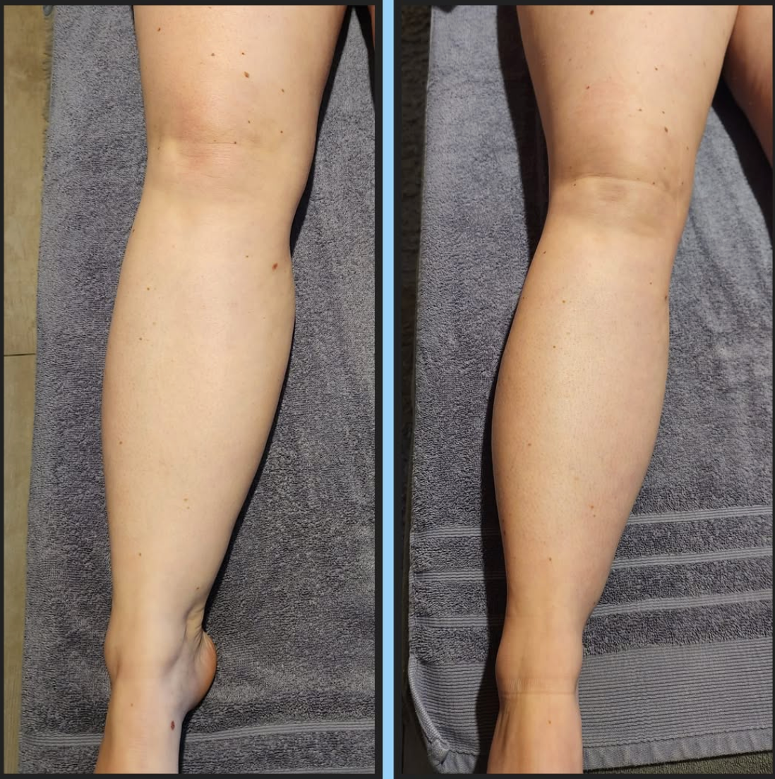 Naéa® : Cure Détox Drainante 100% Naturelle