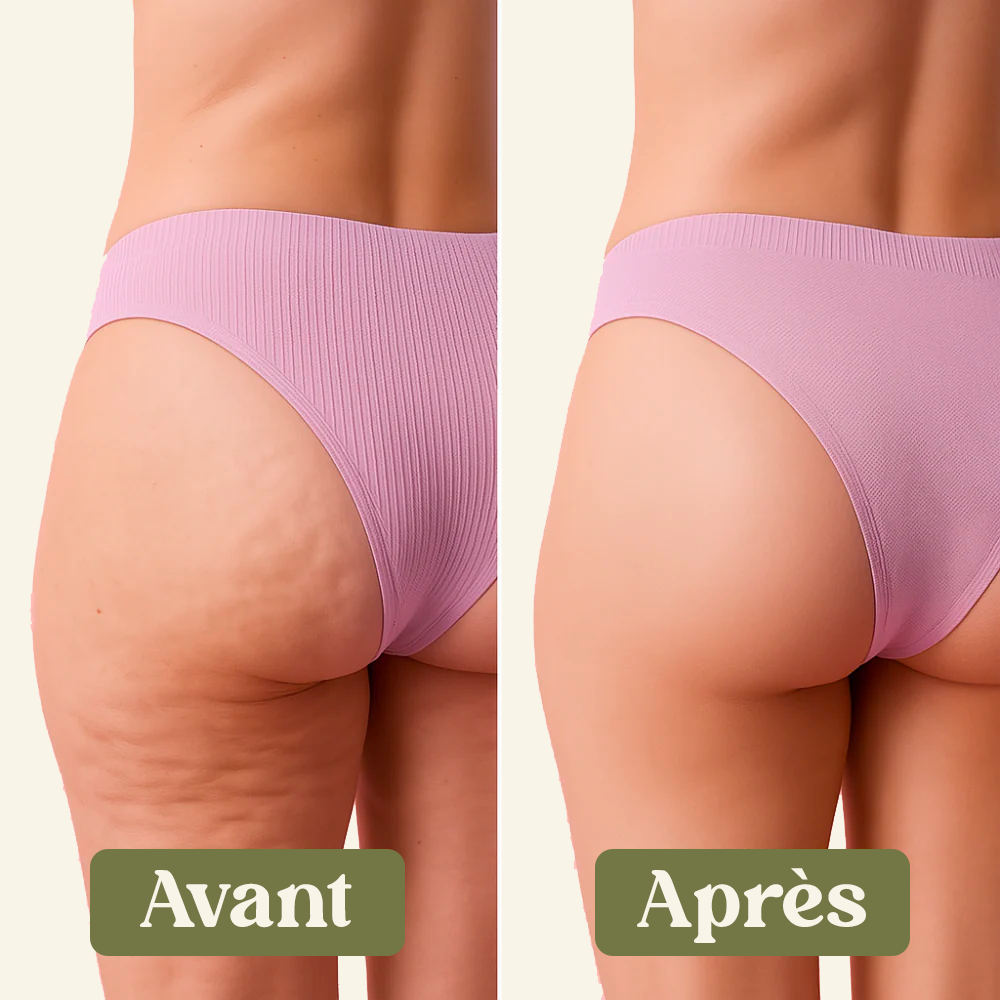 Crème Anti-Cellulite 100% Naturelle Naéa®