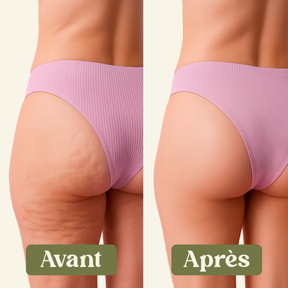 Crème Anti-Cellulite 100% Naturelle Naéa®